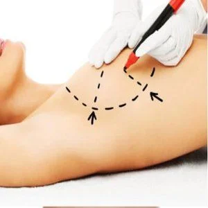 augmentation-mammaire1