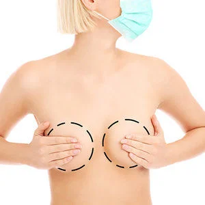 lipofilling-mammaire